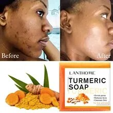 Turmeric 5-piece moisturizing care set brighten skin and restore skin elasticity.