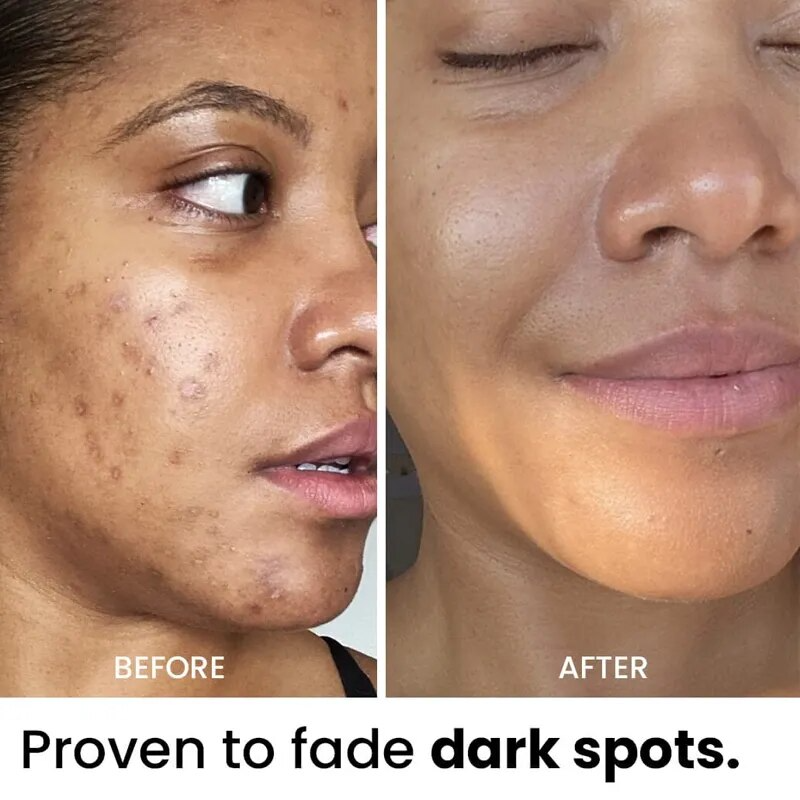 Turmeric 5-piece moisturizing care set brighten skin and restore skin elasticity.