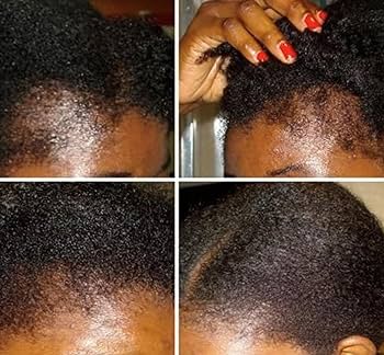 LaBB Skincare Fast Hair Growth Oil (Huile pour la croissance rapide des cheveux)
